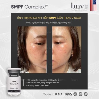 TINH CHẤT TIÊM ĐẸP DA SMPF COMPLEX ( BNV)